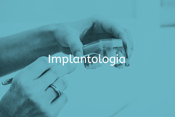 implantologia a reus
